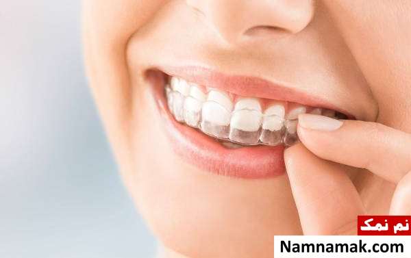 استفاده کردن از نایت گارد دندان