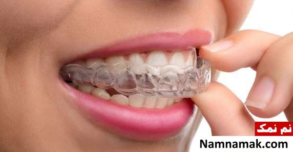 استفاده از نایت گارد در طول روز