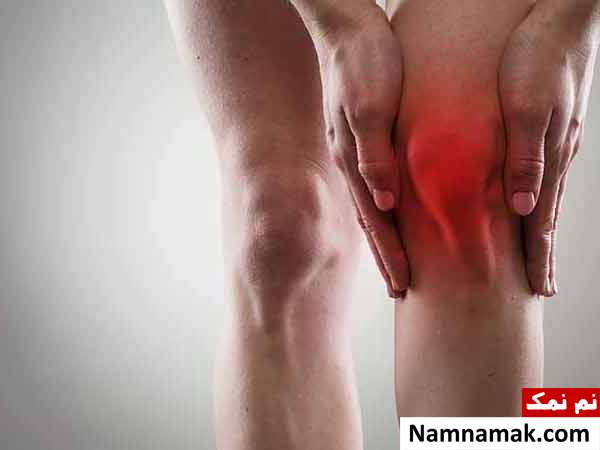 علت اصلی آب آوردن زانو چیست؟ + پیشگیری و درمان بورسیت علت آب آوردن زانو