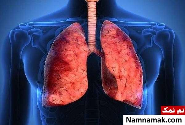 نمک درمانی چیست؟ مزایا و عوارض هالوتراپی سم زدایی ریه با هالوتراپی