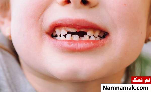 اهمیت و نقش دندان های شیری