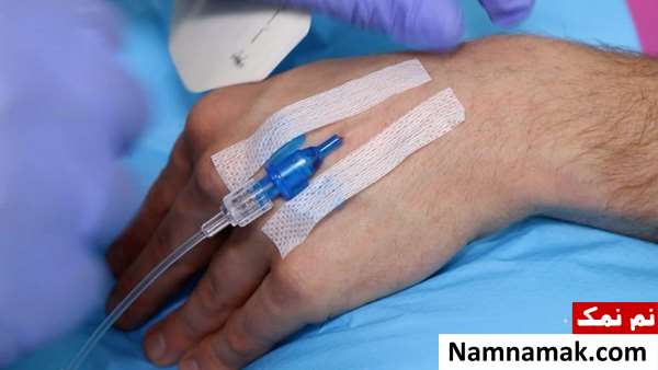 آموزش کامل رگ گیری و نحوه استفاده از آنژیوکت