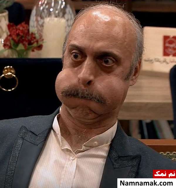 زندگینامه مجید شاپوری و همسرش عکس بادکردن لپ مجید شاپوری