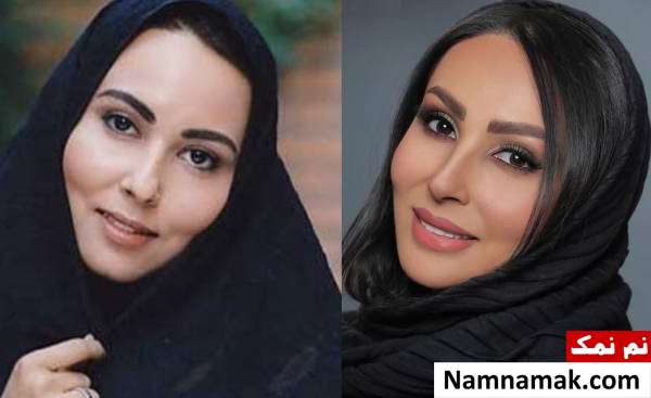 بازیگران زن ایرانی ، تغییر چهره بازیگران زن ایرانی با گذر زمان تغییرات پرستو صالحی