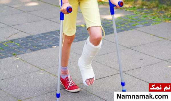 فعالیت های مناسب گچ گرفتگی کودک