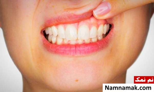 اهمیت وجود لثه های سالم