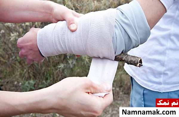 کمک اولیه شکستگی + علائم انواع شکستگی کمک های اولیه برای شکستگی استخوان
