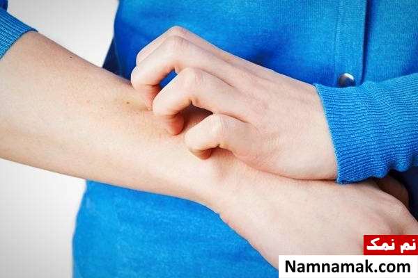واکنش های تاخیری به دارو