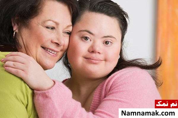 سندرم داون چیست؟ بارداری ، علل ، علائم ، عوارض و درمان چاقی از مشکلات سندرم داون
