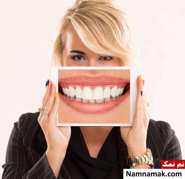 پیشگیری از پوسیدگی دندان با فلوراید درمانی