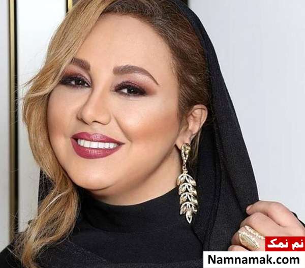 کامپوزیت یا لمینت دندانهای بهنوش بختیاری