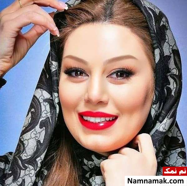 کامپوزیت یا لمینت دندانهای سحر قریشی