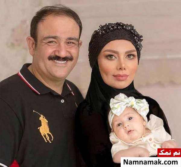 کامپوزیت یا لمینت دندانهای مهران غفوریان