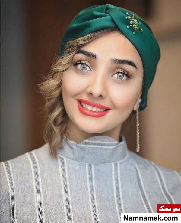 کامپوزیت یا لمینت دندانهای دریا مرادی دشت