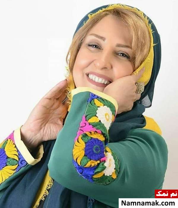 کامپوزیت یا لمینت دندانهای مرجانه گلچین