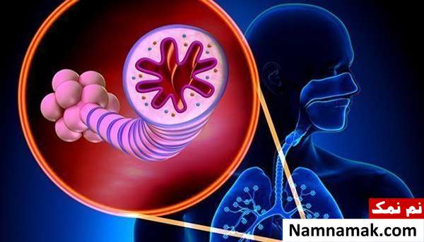 آیا آسم باعث عفونت ریه می شود؟