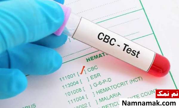 آزمایش شمارش کامل سلول های خونی یا CBC آزمایش خون تشخیص سرطان