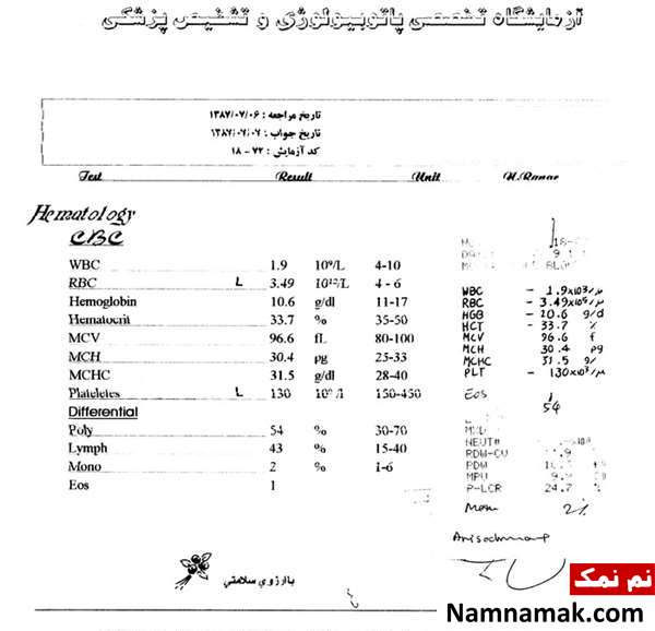 تفسیر آزمایش سرطان خون و عکس آزمایش سرطان خون مثبت