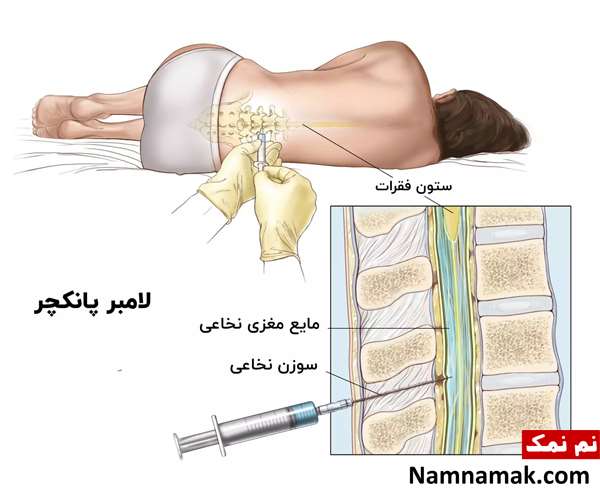 تفسیر آزمایش سرطان خون و عکس آزمایش سرطان خون مثبت