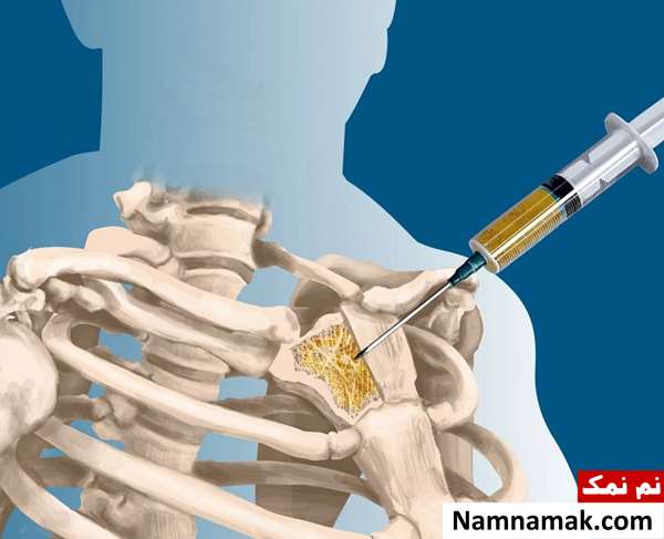 تشخیص سرطان در مراحل اولیه تشخیص سرطان در مراحل اولیه