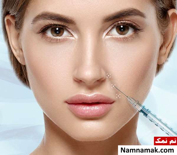 بهترین مارک ژل برای تزریق خط خنده بهترین مارک ژل برای تزریق خط خنده