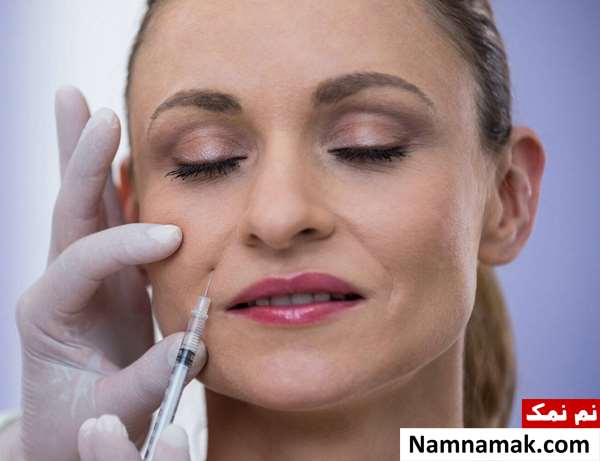 قیمت تزریق ژل برای خط خنده و هزینه های آن قیمت تزریق ژل برای خط خنده و هزینه های آن