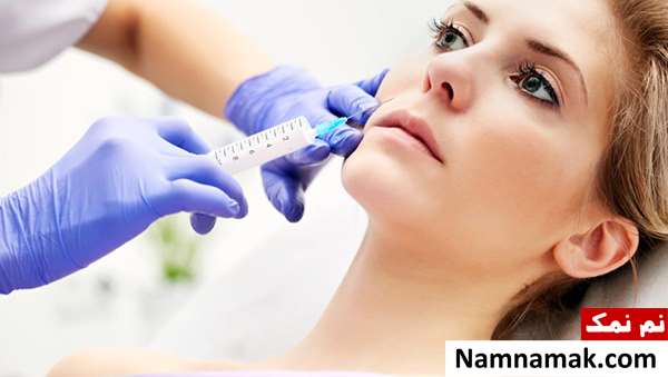 عوارض تزریق ژل خط خنده و مضرات آن