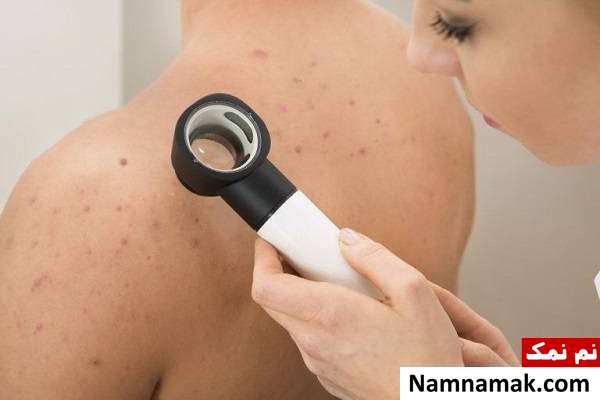 جلوگیری از جوش زدن بدن با لباس مناسب راه جلوگیری از جوش زدن بدن