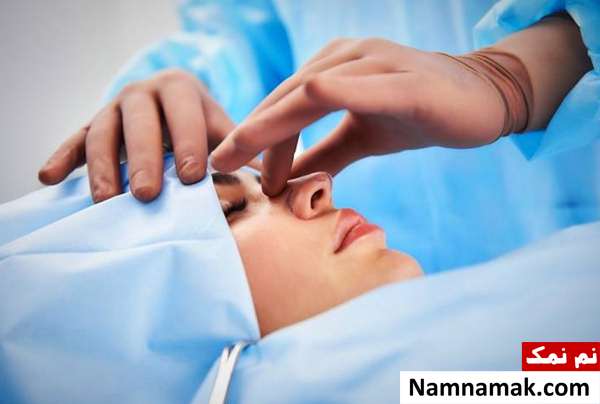 عمل بینی ، ملاک و نکات عمل جراحی بینی خوب و زیبا جراحی بینی باز یا بسته؟