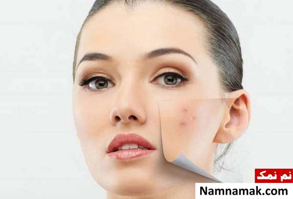 31 مهمترین خواص و فواید چای سیاه برای زیبایی ، لاغری و سلامت کاهش لکه های پوستی با چای سیاه