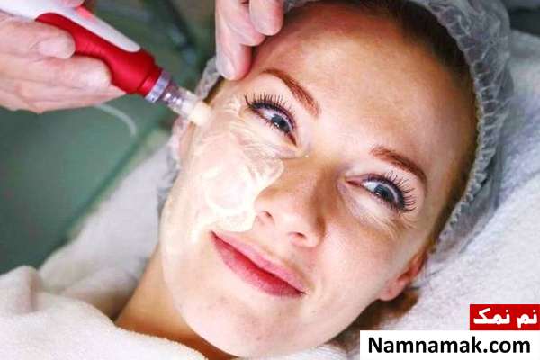 طریقه انجام مزووایت صورت