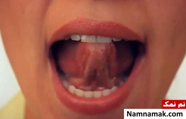از بین بردن غبغب با جویدن آدامس چگونه غبغب را آب کنیم؟