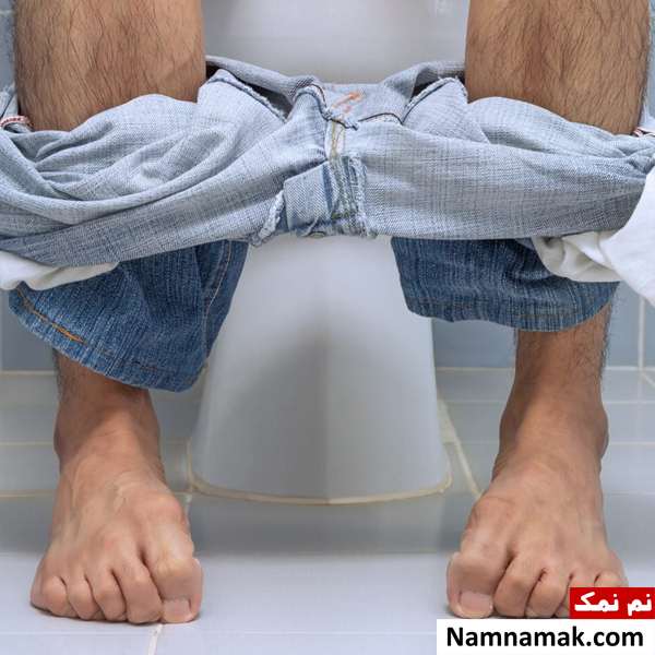علت و علائم و نحوه درمان بواسیر دکمه ای یا ساچمه ای بواسیر دکمه ای