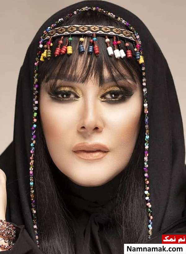 شیوا خسرو مهر بعد از تزریق ژل شیوا خسرو مهر بعد از عمل زیبایی