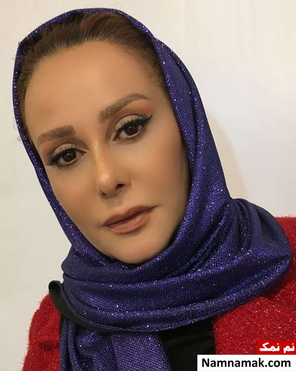 شیوا خسرو مهر بعد از تزریق ژل شیوا خسرو مهر بعد از عمل زیبایی