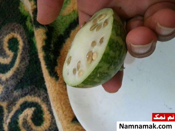 کمپرس سرد برای درد عصب دندان