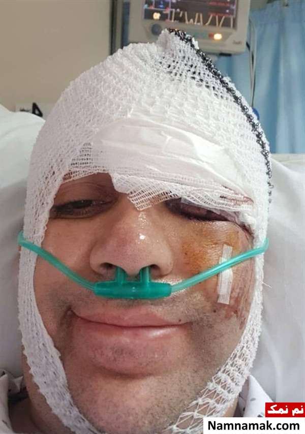 بیوگرافی امیر کربلایی زاده و همسرش پوران مرادی ماجرای تصادف امیر کربلایی زاده