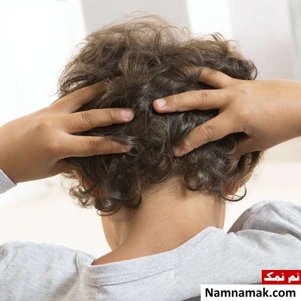 آیا شپش باعث ریزش مو میشود؟