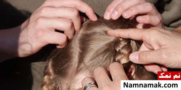 آیا آفتاب شپش را میکشد؟