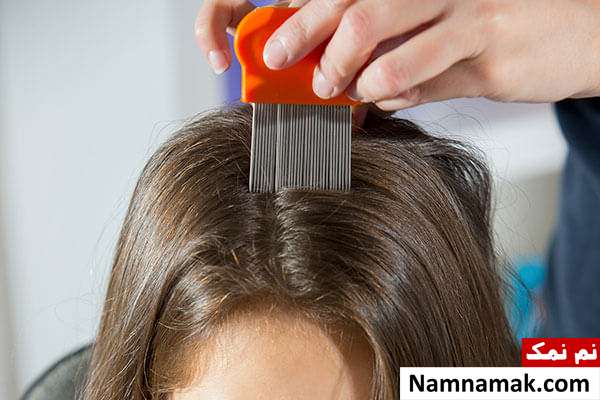 آیا آفتاب شپش را میکشد؟
