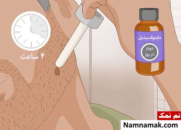 استفاده از ماینوکسیدیل روی ریش
