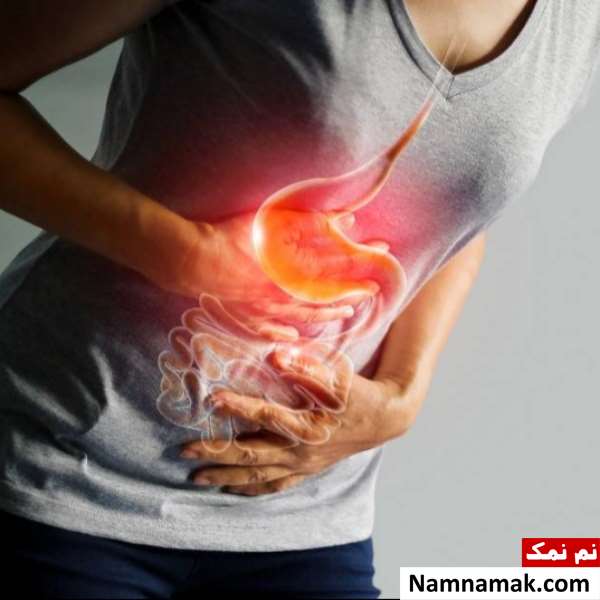 بهترین مکمل ، قرص و ویتامین برای روده تحریک پذیر بهترین مکمل ، قرص و ویتامین برای روده تحریک پذیر