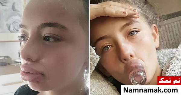 برجسته کردن دائمی لب با لیوان در خانه