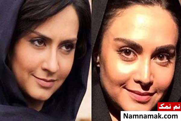 زندگینامه مریم خدارحمی و همسرش مریم خدارحمی قبل و بعد از عمل بینی