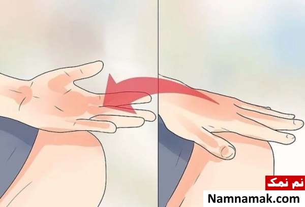 ورزش مچ دست بعد از شکستگی ورزش مچ دست بعد از شکستگی