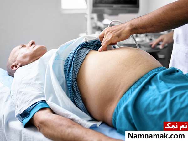 آیا آب آوردن شکم خطرناک است؟