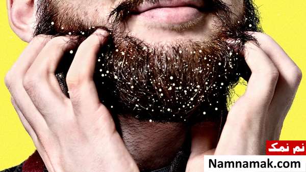 شامپوی ضد شوره ریش شامپوی ضد شوره ریش