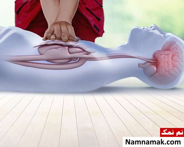 روش انجام احیای قلبی