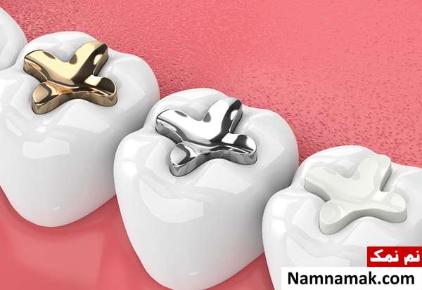 آیا ترمیم دندان نیاز به بی حسی دارد؟