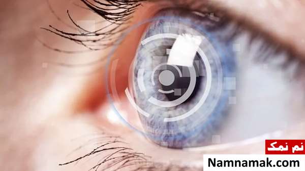 علت و علائم آب مروارید چشم